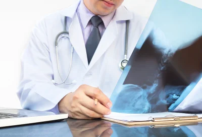 doctor-examine-x-ray-film-white-background_1150-6251 doctor-examine-x-ray-film-white-background_1150-6251
