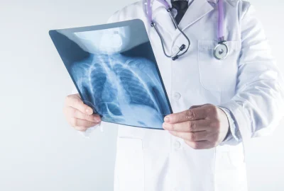 doctor-examining-chest-x-ray-film-patient-hospital_1205-6821 doctor-examining-chest-x-ray-film-patient-hospital_1205-6821