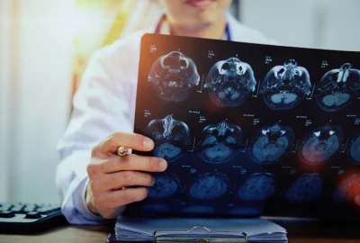 doctor-with-mri-xray-brain-scans_43569-133 doctor-with-mri-xray-brain-scans_43569-133